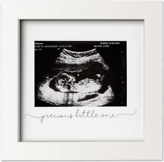 Baby Sonogram Picture Frame (Alpine White)